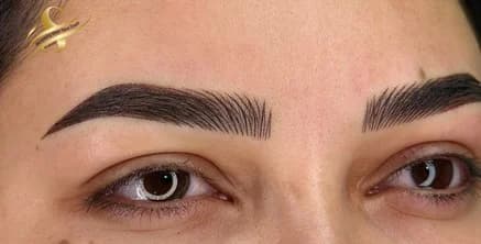 Sourcils — après